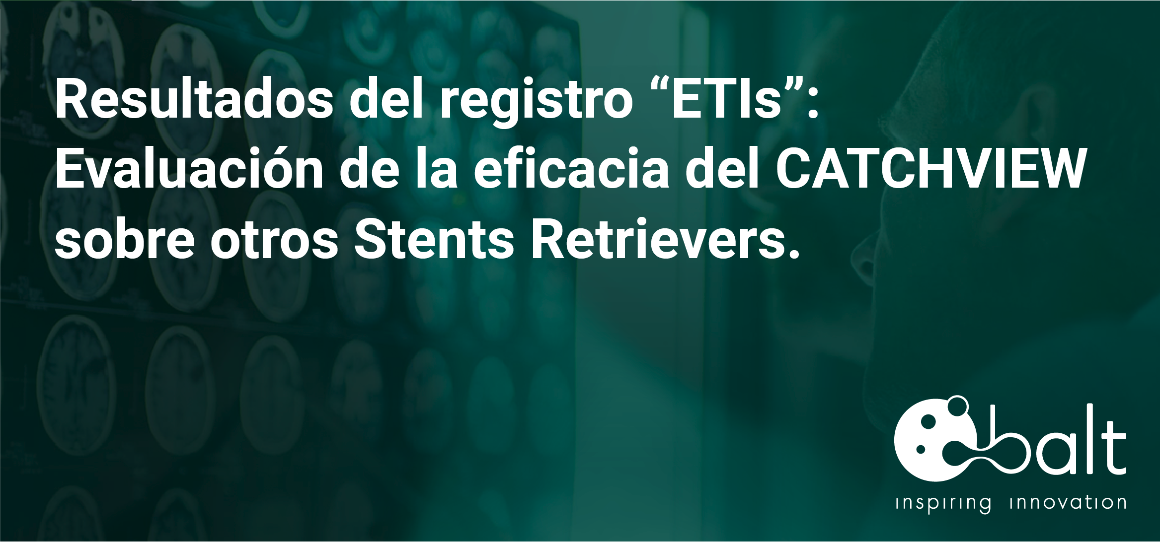 Evaluación de CATCHVIEW versus Stent Retriever estándar para el tratamiento endovascular del ictus: resultados del registro ETIS